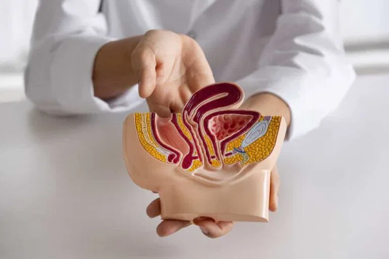 شفيت من دوالي الخصية بدون جراحة