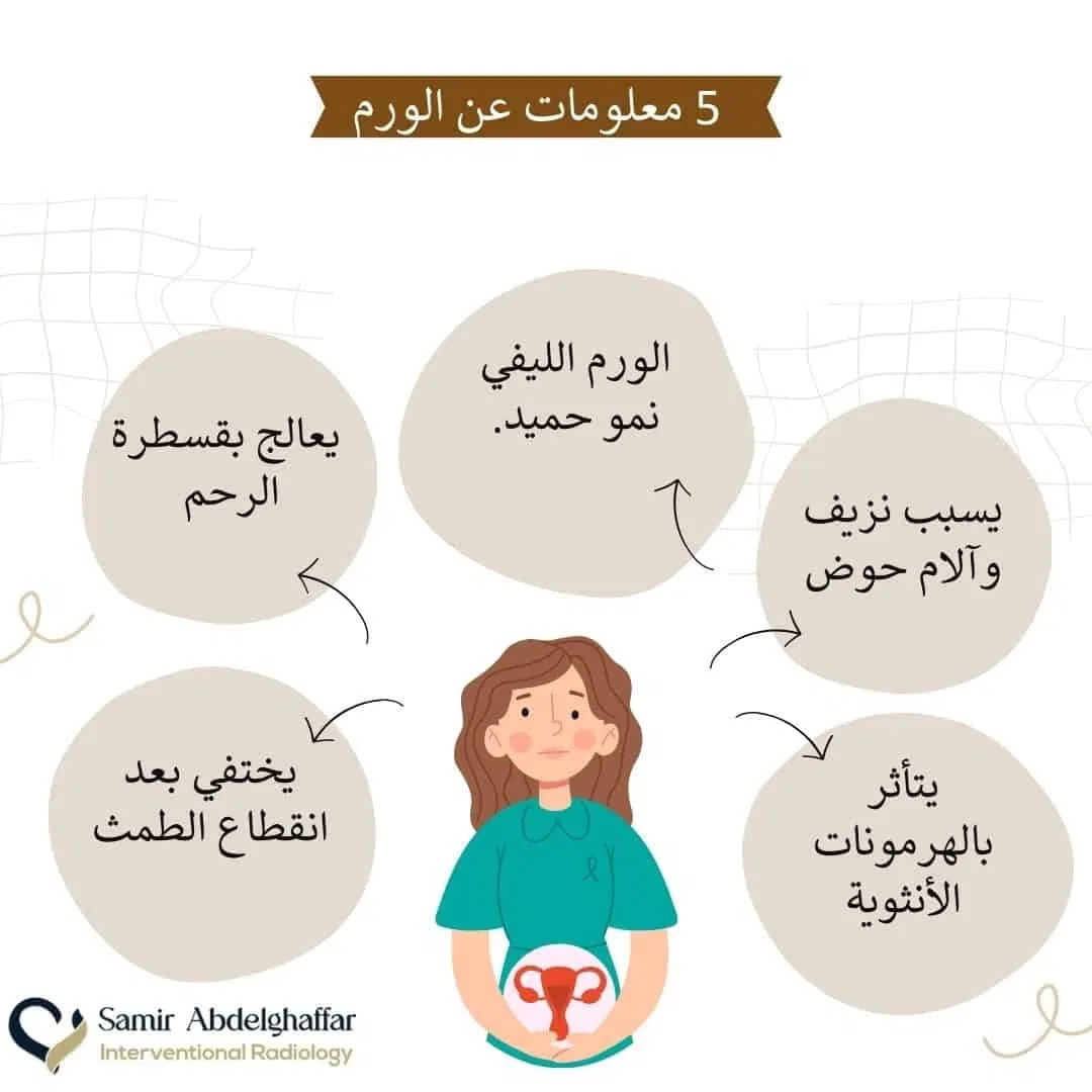 نصائح للوقاية من الورم الليفي