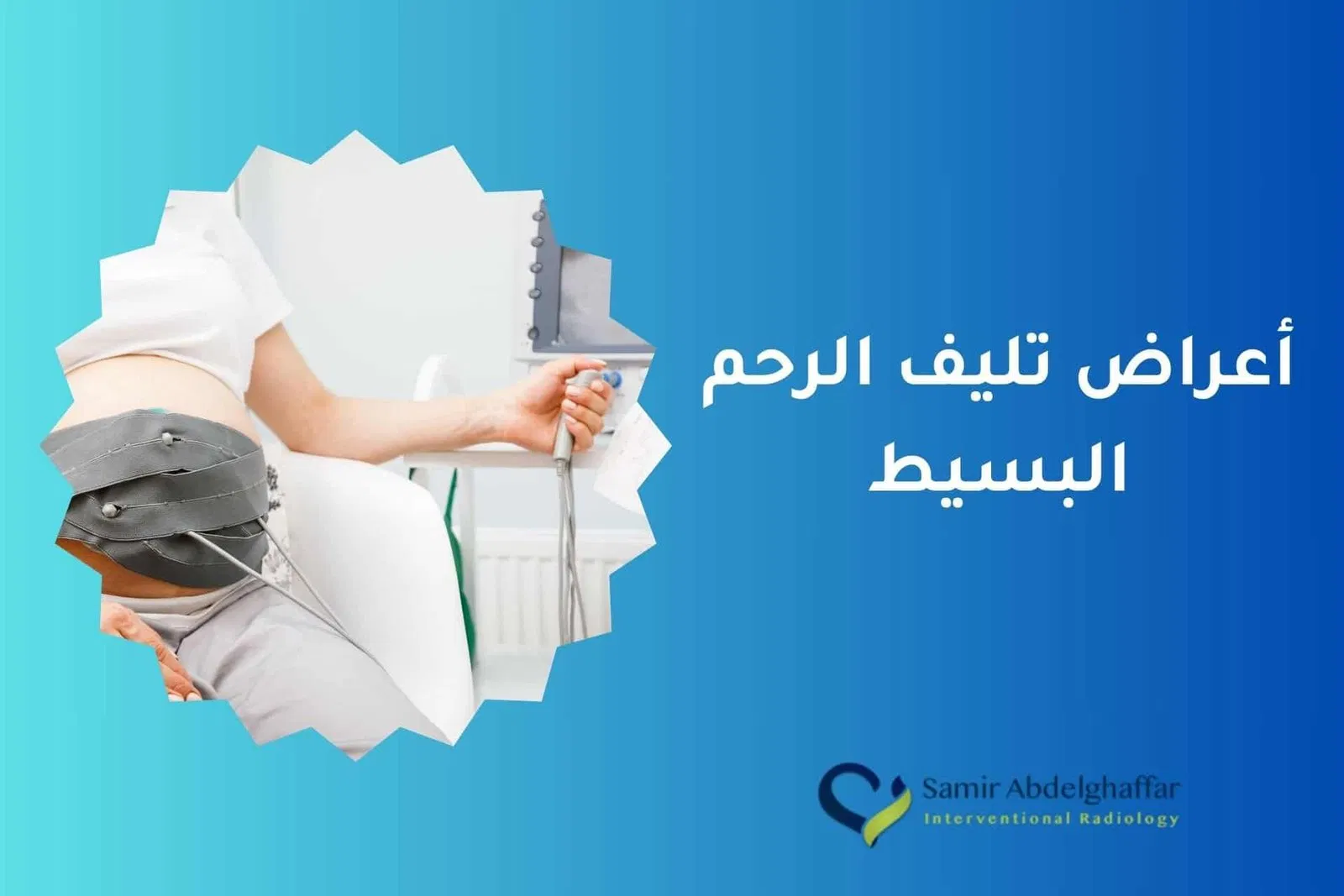 أعراض تليف الرحم البسيط