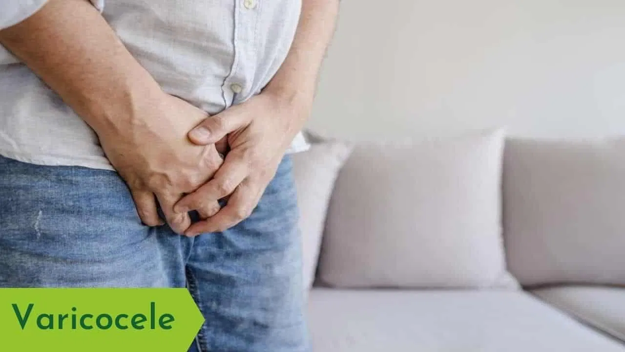 Varicocele 2