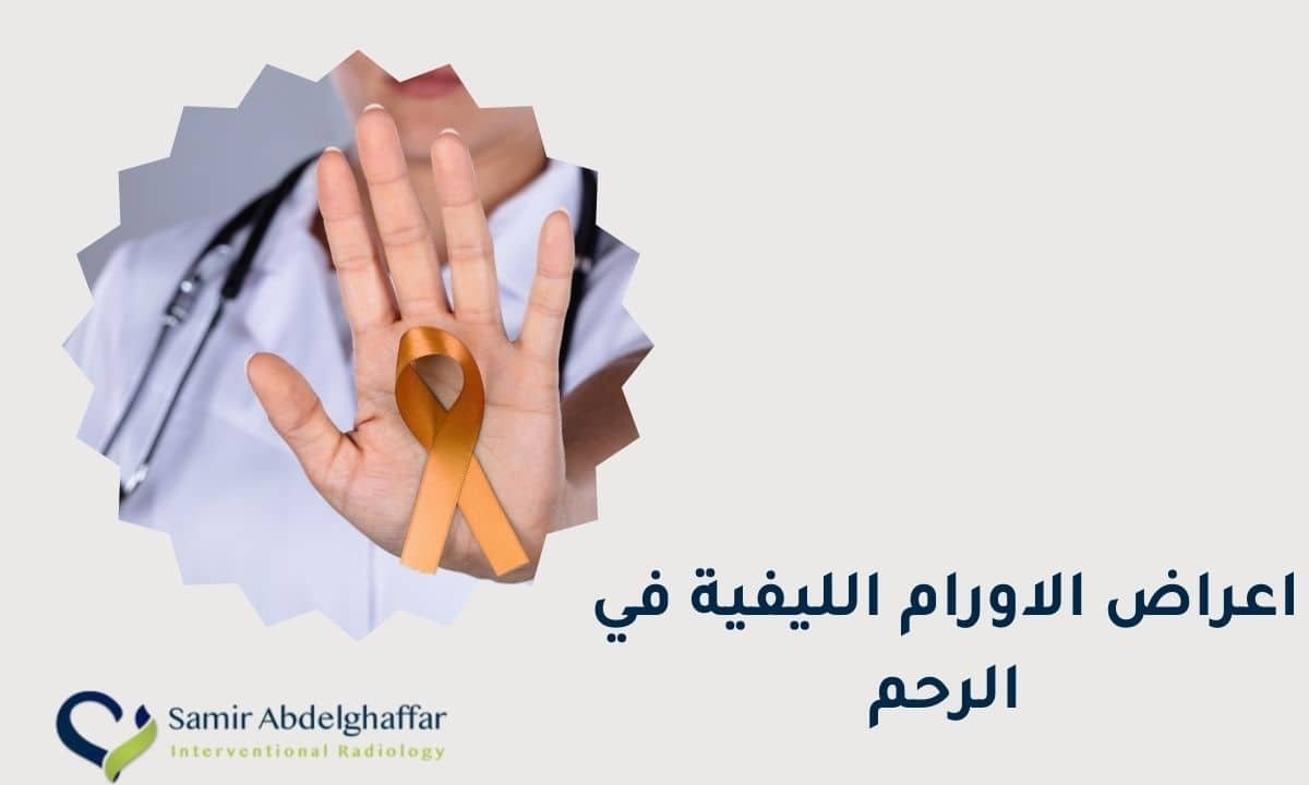 اعراض اورام الرحم الليفية 1 أعراض الأورام الليفية في الرحم
اعراض اورام الرحم الليفية