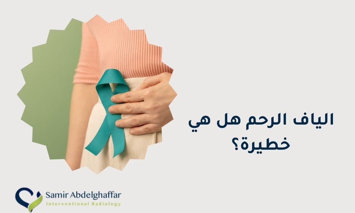 الياف الرحم هل هي خطيرة؟ حقائق يجب معرفتها 1 الياف الرحم هل هي خطيرة