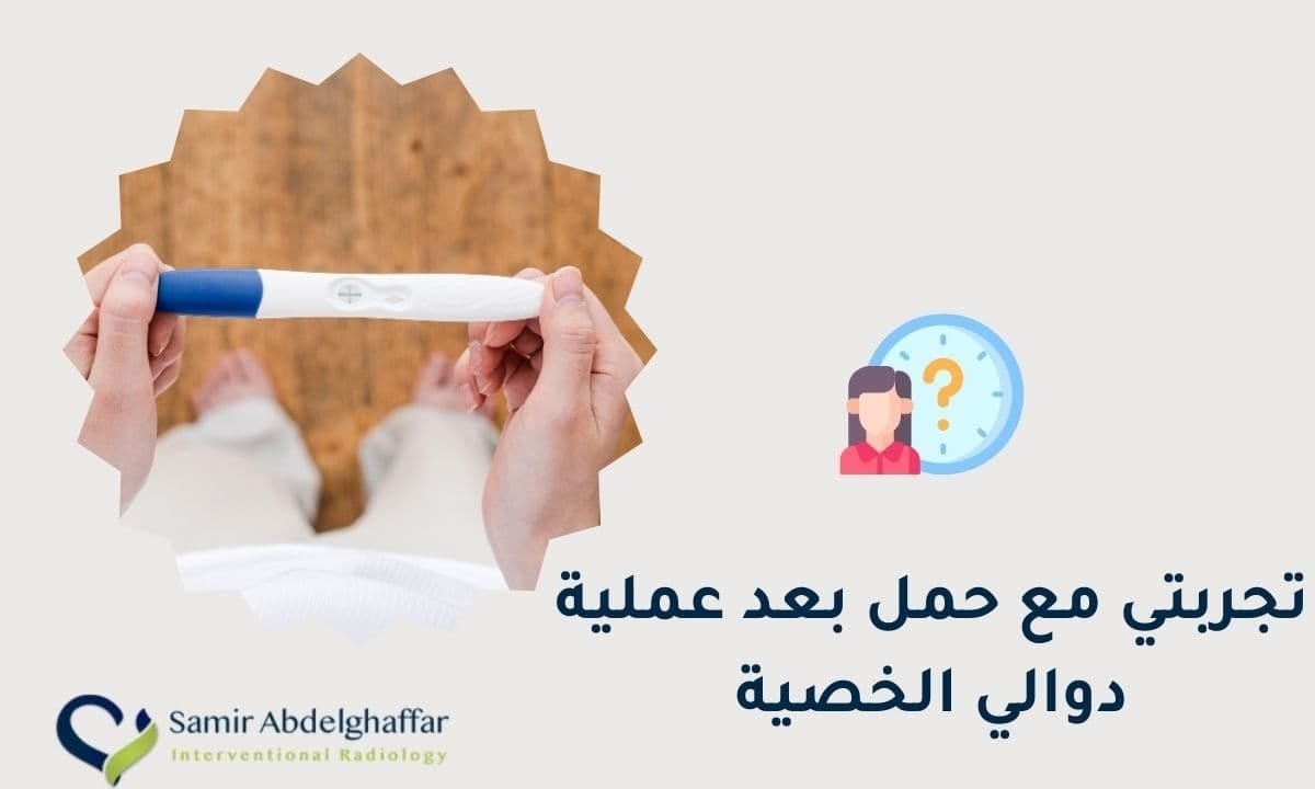 تجربتي مع حمل بعد عملية دوالي الخصية 1 تجربتي مع حمل بعد عملية دوالي الخصية