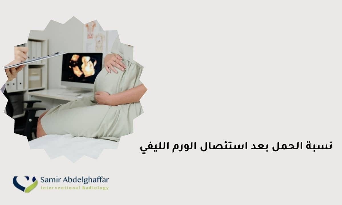 نسبة الحمل بعد استئصال الورم الليفي: ما يجب معرفته 1 نسبة الحمل بعد استئصال الورم الليفي