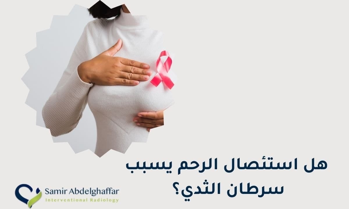 هل استئصال الرحم يسبب سرطان الثدي؟ اعرفي الإجابة! 1 هل استئصال الرحم يسبب سرطان الثدي؟