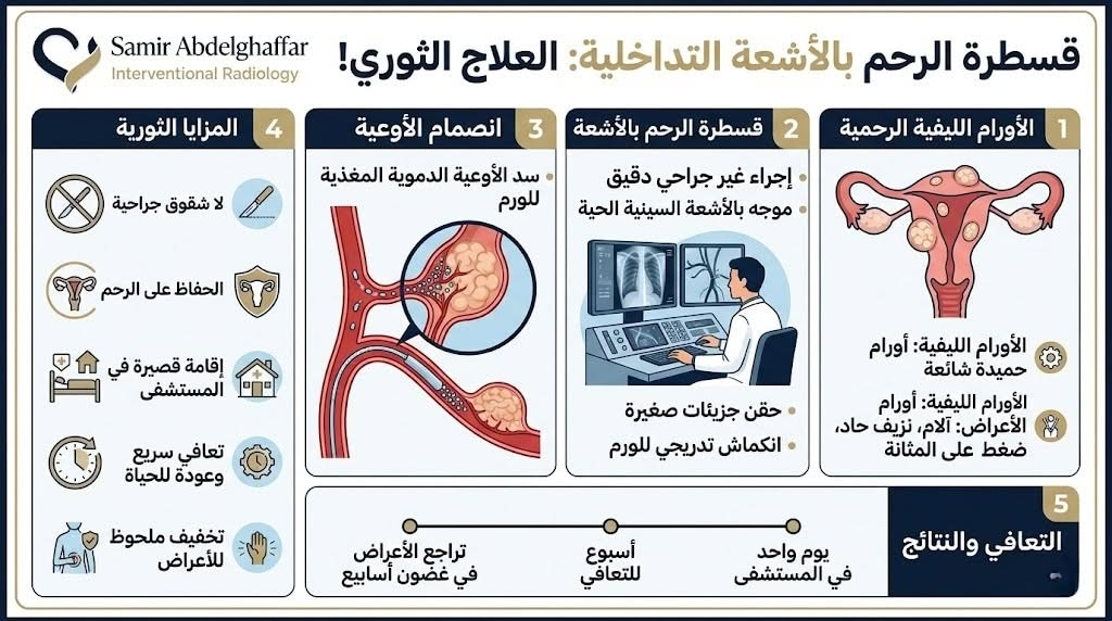 علاج التغدد الرحمي بدون استئصال الرحم 3 قسطرة الرحم بالأشعة التداخلية: العلاج الثوري!