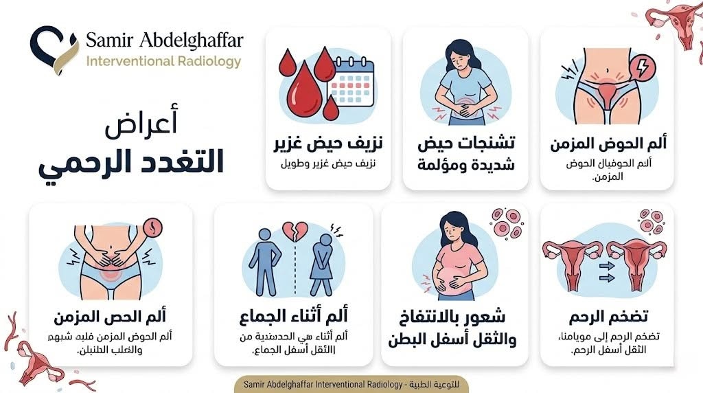 علاج التغدد الرحمي بدون استئصال الرحم 2 أعراض التغدد الرحمي: علامات لا يجب تجاهلها!