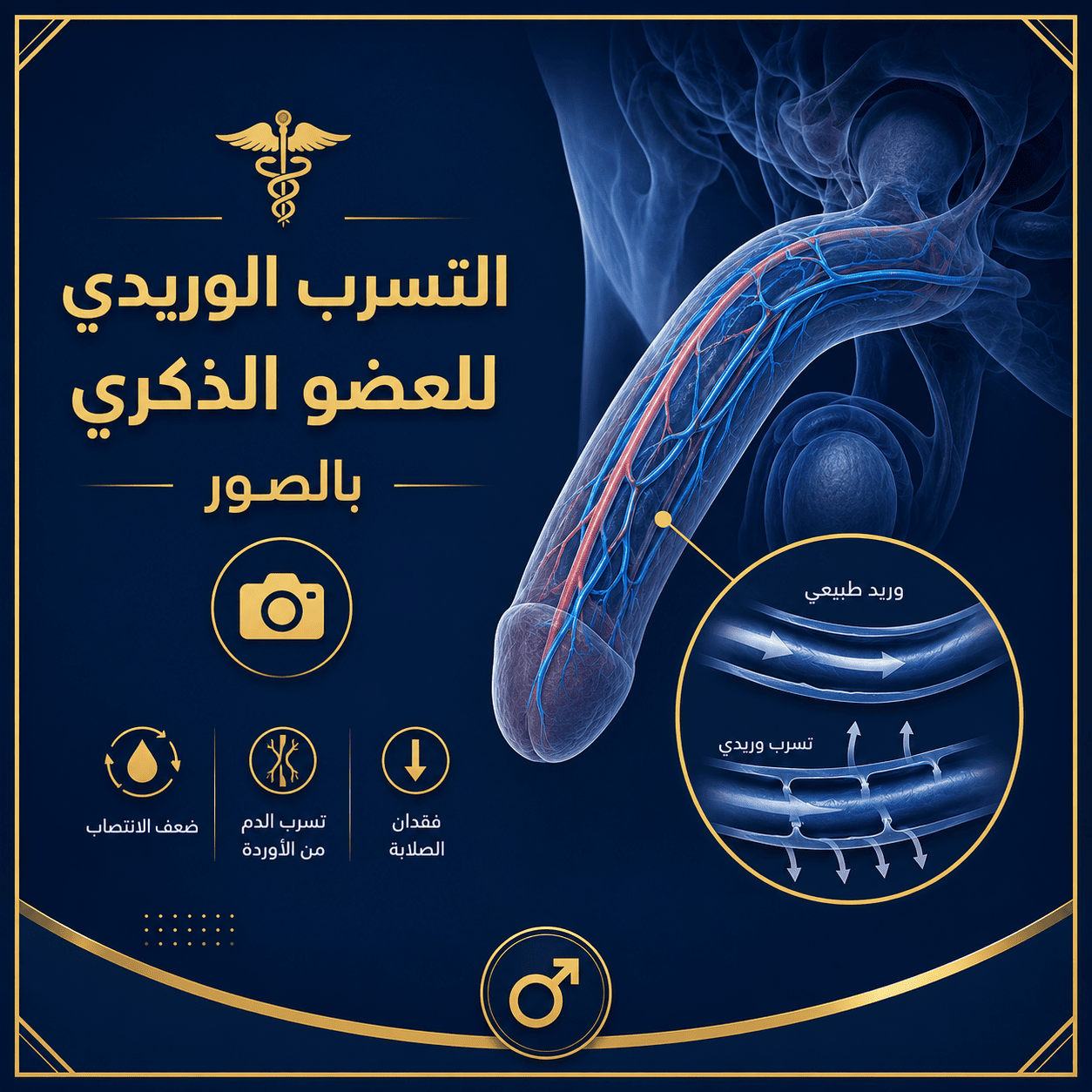 تكلفة علاج التسرب الوريدي