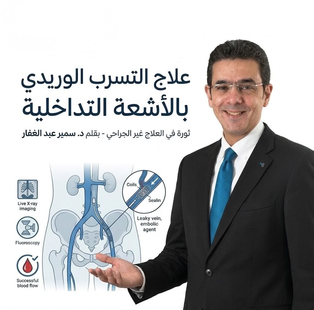 علاج التسرب الوريدي بالاشعة التداخلية بدون جراحة 1 علاج التسرب الوريدي بالاشعة التداخلية