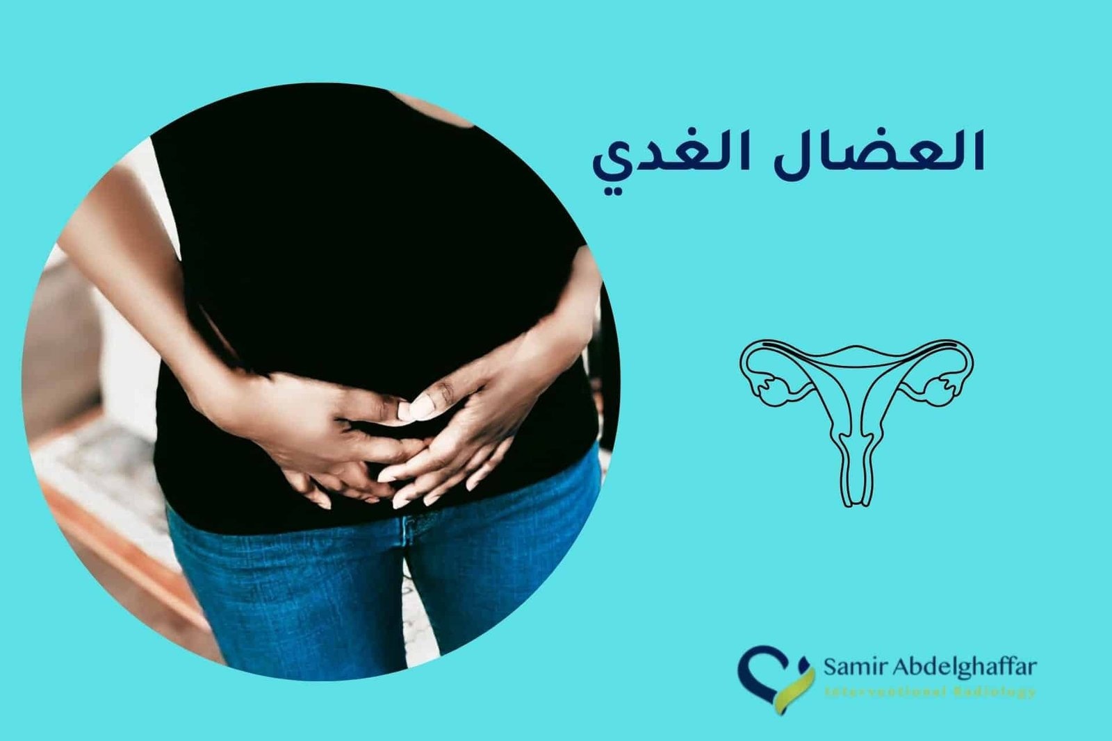 العضال الغدي الرحمي 