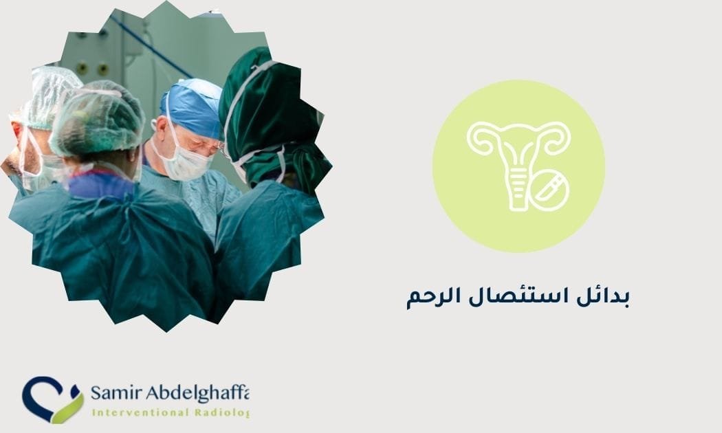 بدائل استئصال الرحم الأكثر أمانا 1 بدائل استئصال الرحم