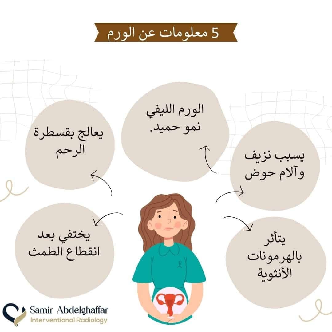 نصائح للوقاية من الورم الليفي