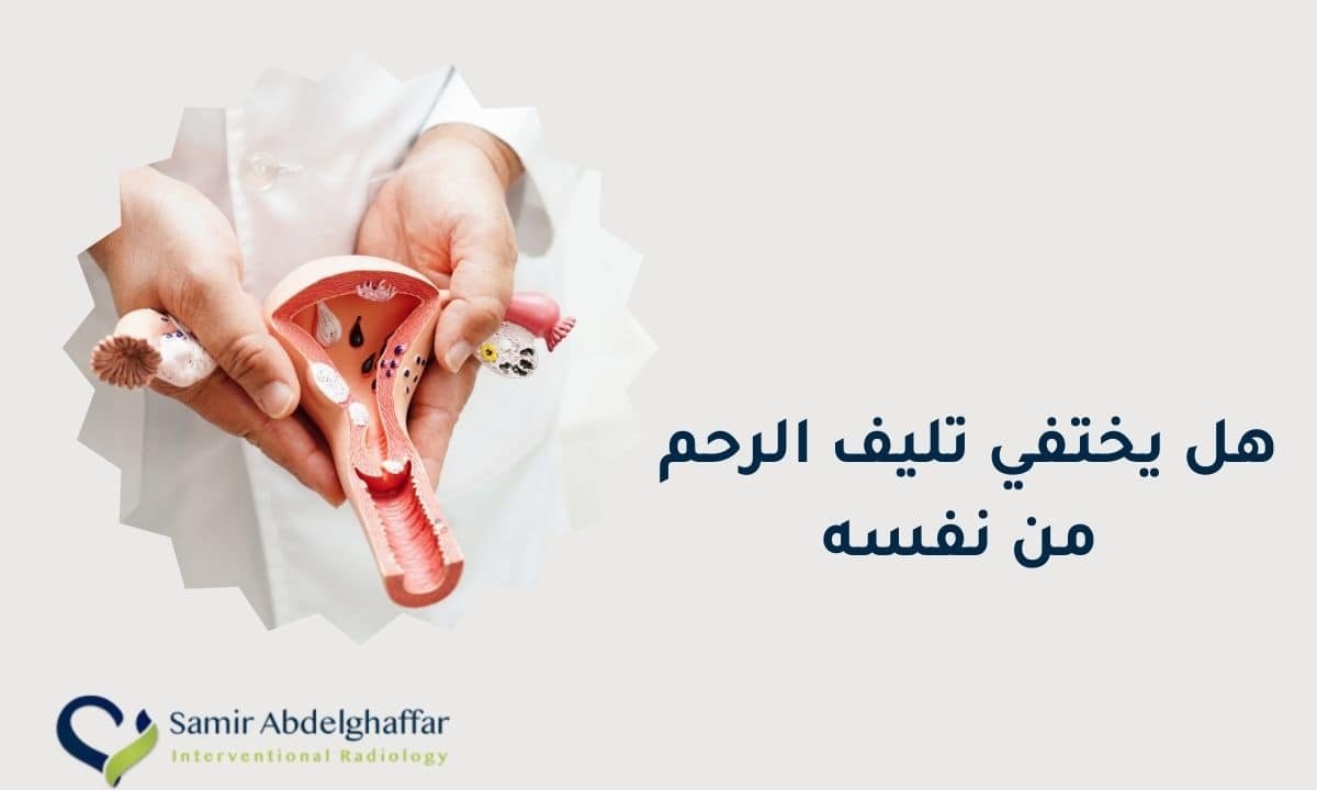 هل يختفي تليف الرحم من نفسه؟ اعرفي الإجابة الآن 1 هل يختفي تليف الرحم من نفسه