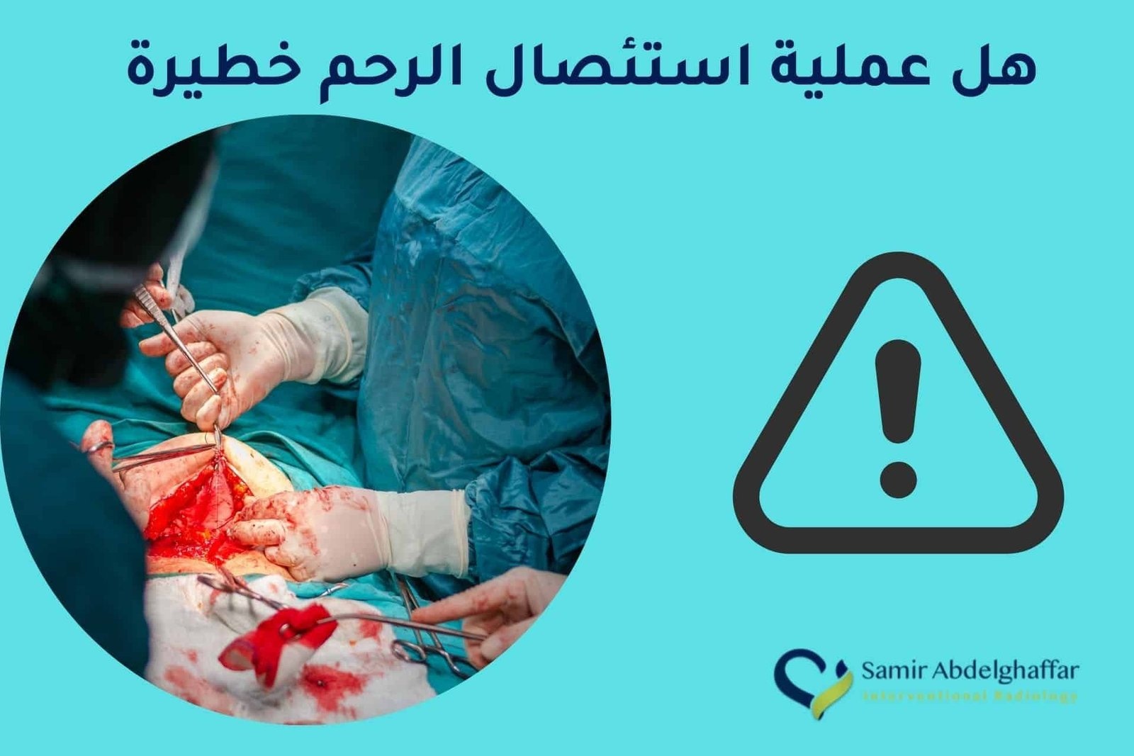 هل عملية استئصال الرحم خطيرة