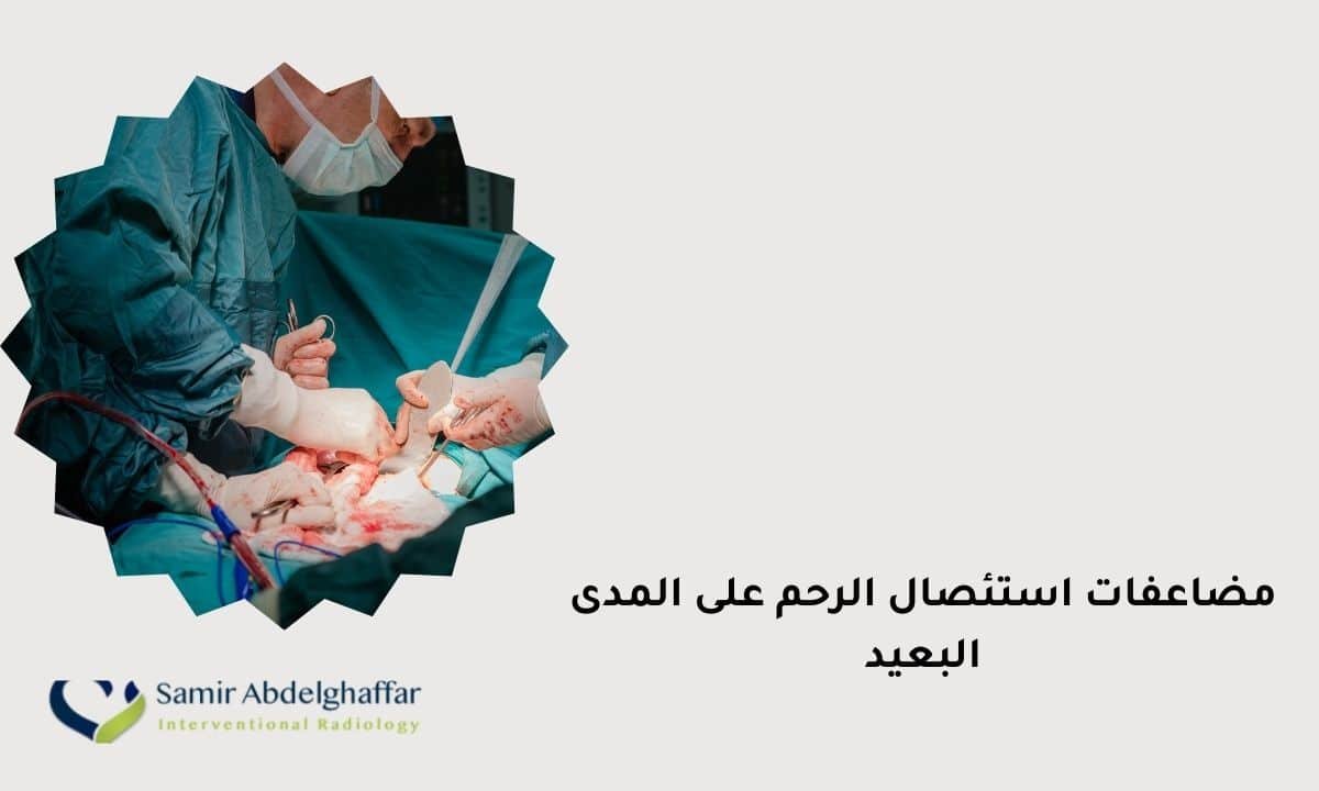مضاعفات استئصال الرحم على المدى البعيد 1 مضاعفات استئصال الرحم على المدى البعيد