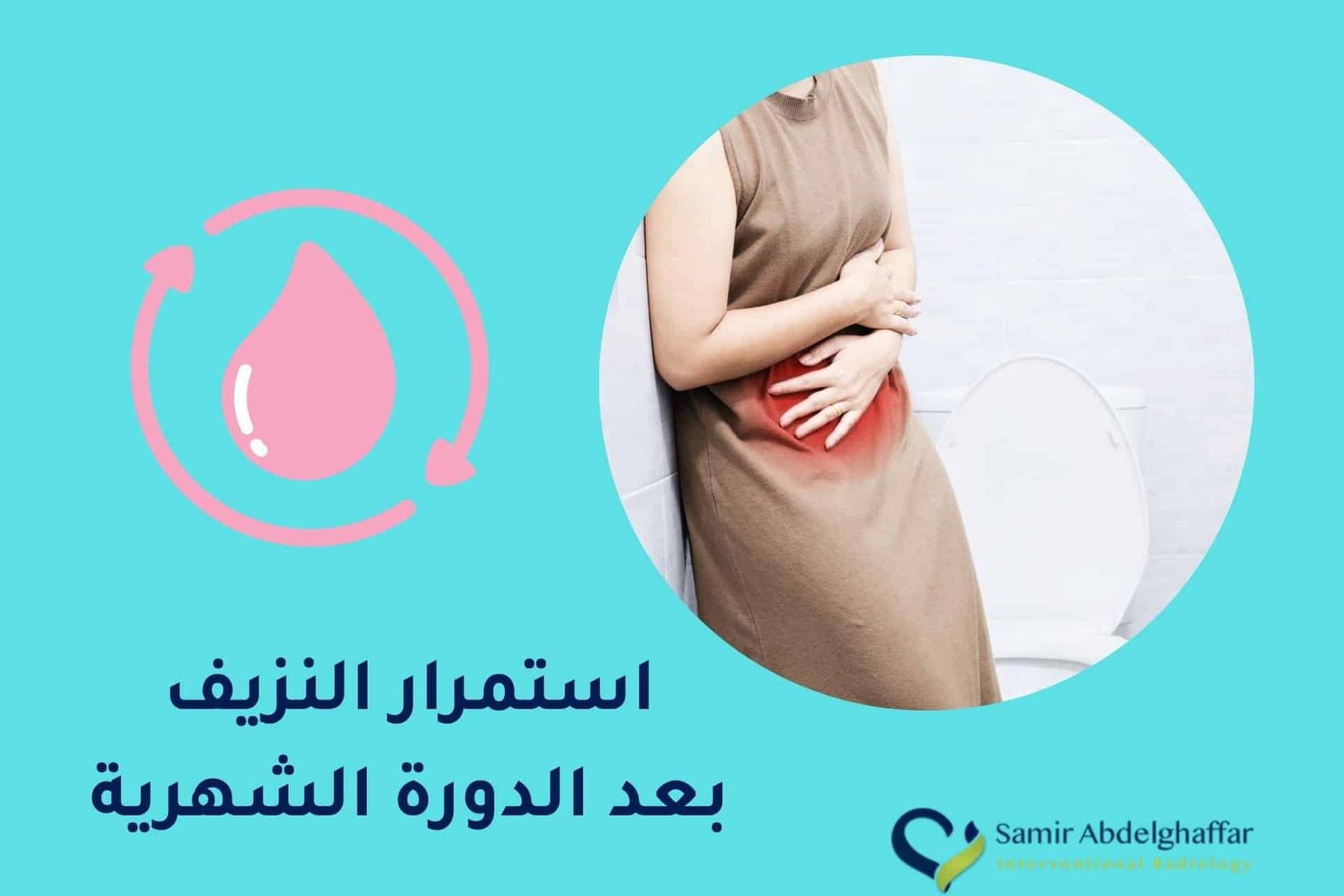 اسباب استمرار النزيف بعد الدورة الشهرية: اعرفيها الآن 1 اسباب استمرار النزيف بعد الدورة الشهرية