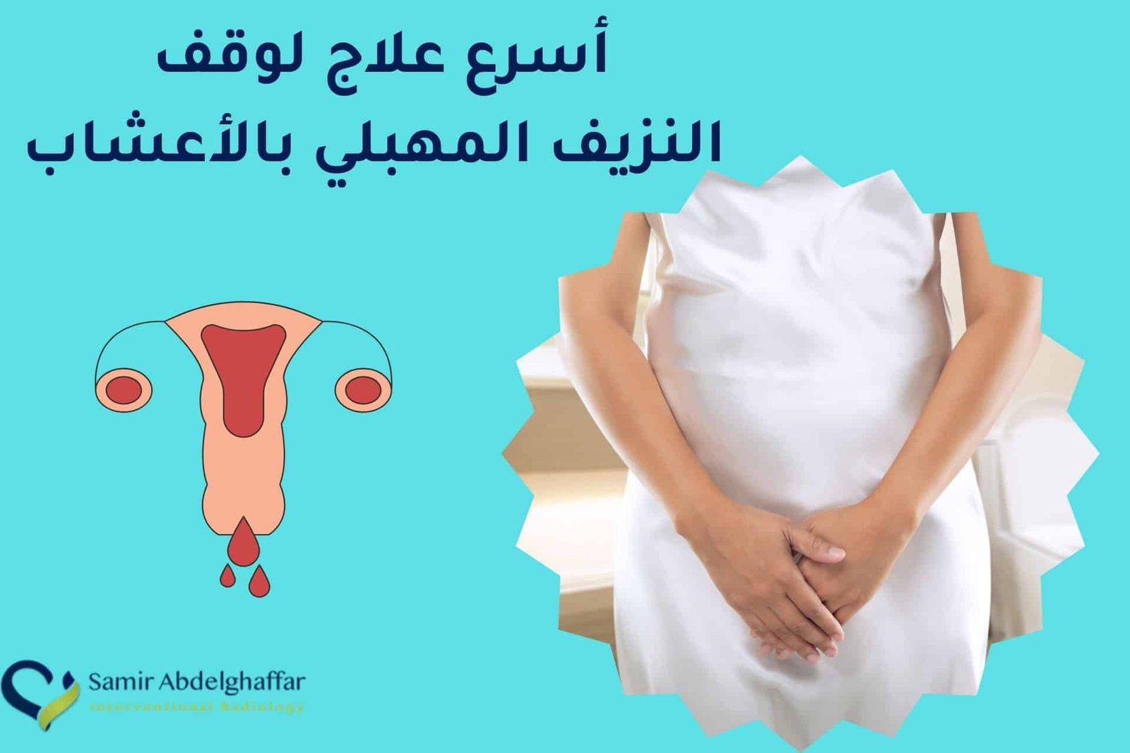 علاج النزيف المهبلي بالأشعة التداخلية
