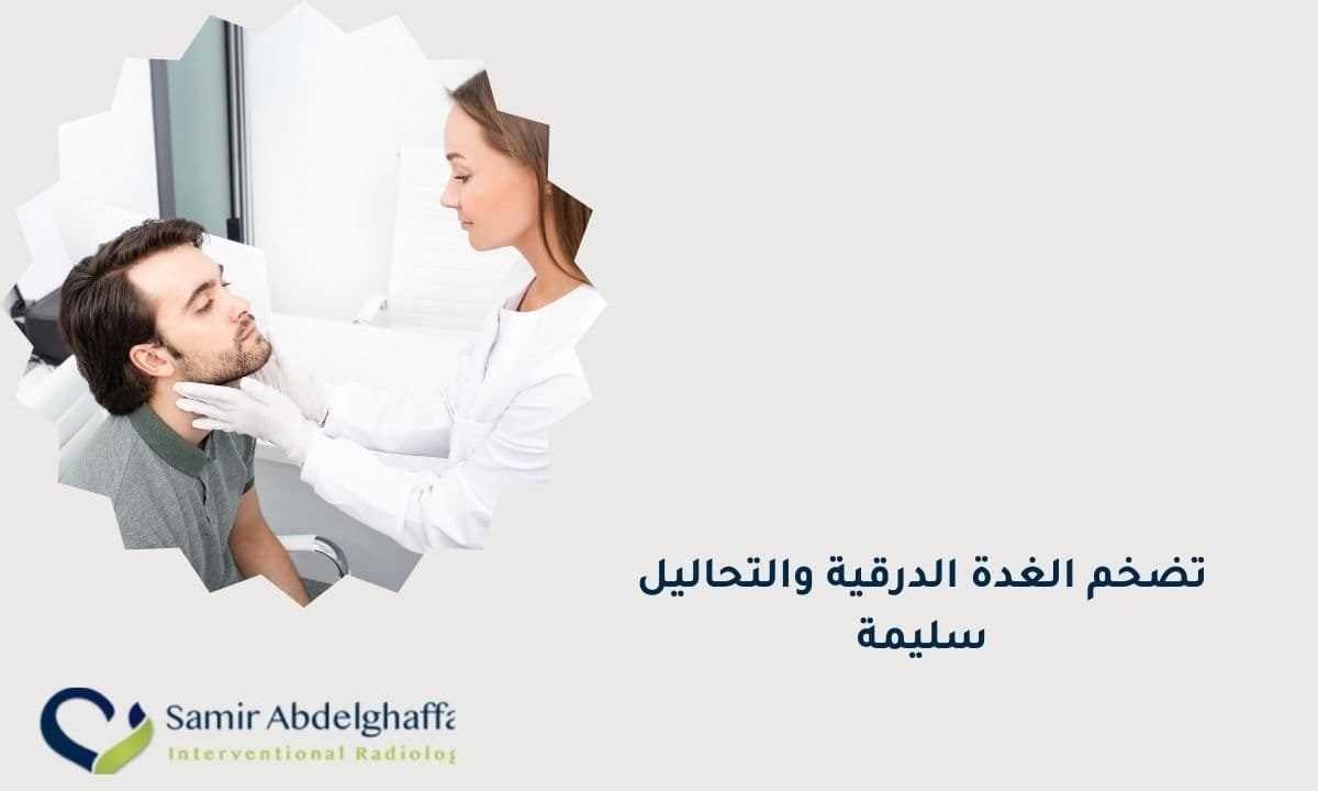 تضخم الغدة الدرقية والتحاليل سليمة