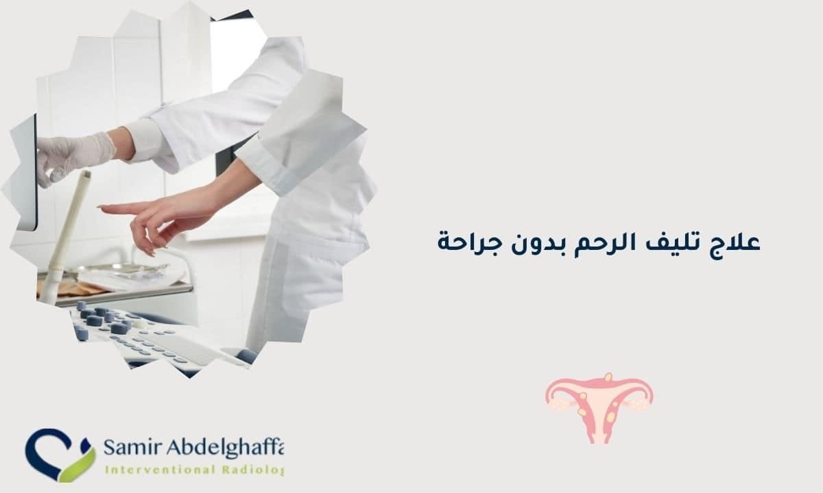 علاج تليف الرحم بدون جراحة