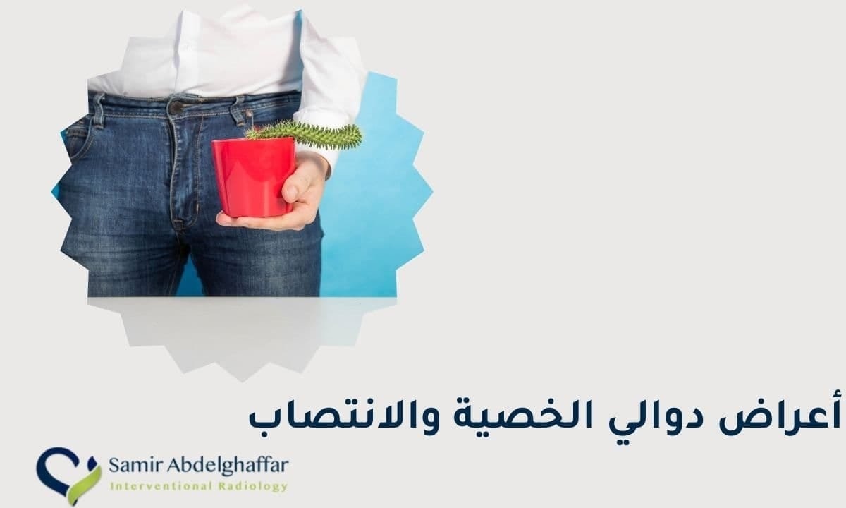 أعراض دوالي الخصية والانتصاب