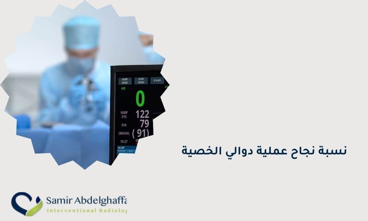 نسبة نجاح عملية دوالي الخصية
