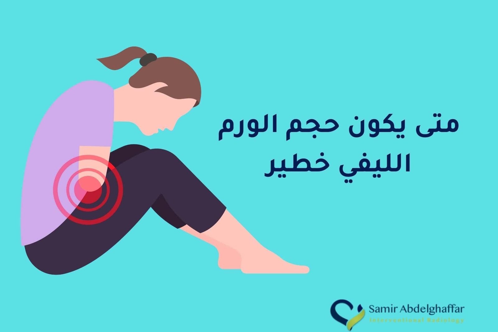 متى يكون حجم الورم الليفي خطير