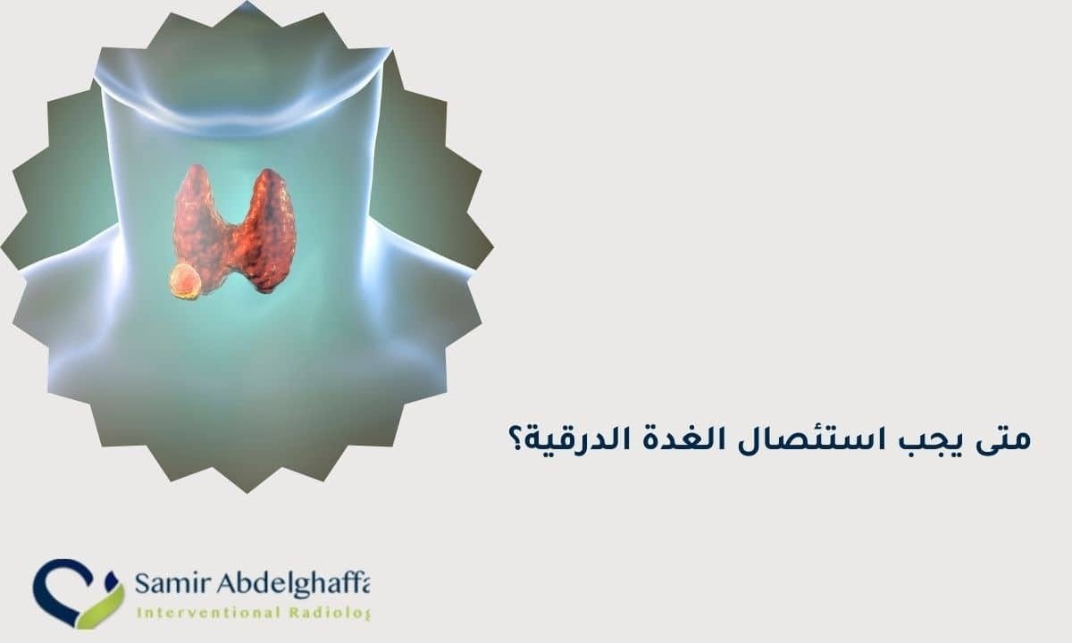 متى يجب استئصال الغدة الدرقية؟ 1 متى يجب استئصال الغدة الدرقية