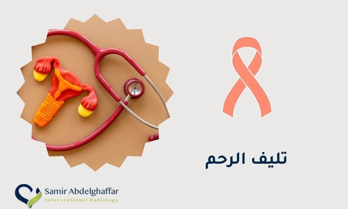 كل ما تحتاجين معرفته عن تليف الرحم وعلاجه بدون جراحة 1 image 4