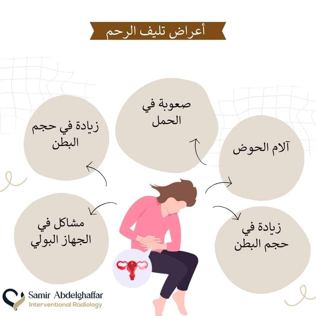 كل ما تحتاجين معرفته عن تليف الرحم وعلاجه بدون جراحة 2 image 5