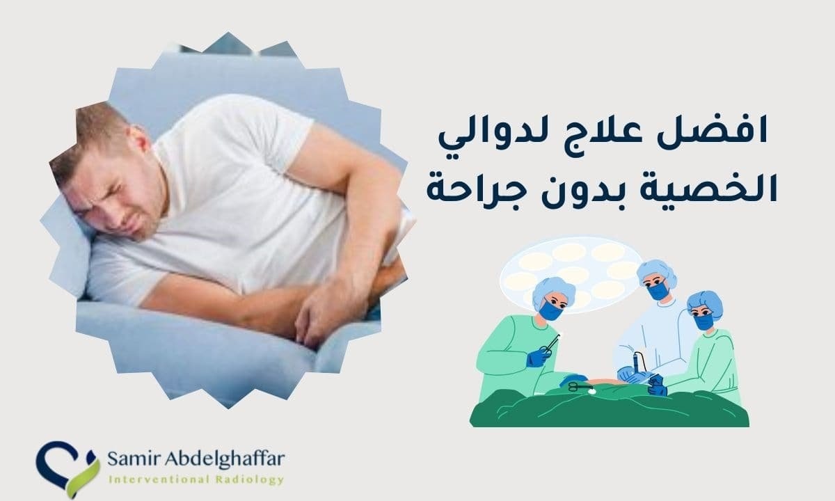 عملية دوالي الخصية بدون جراحة