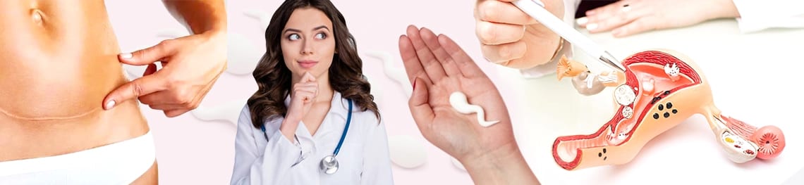 أين يذهب ماء الرجل بعد استئصال الرحم؟ 2 Where Does Sperm Go After Hysterectomy The Facts